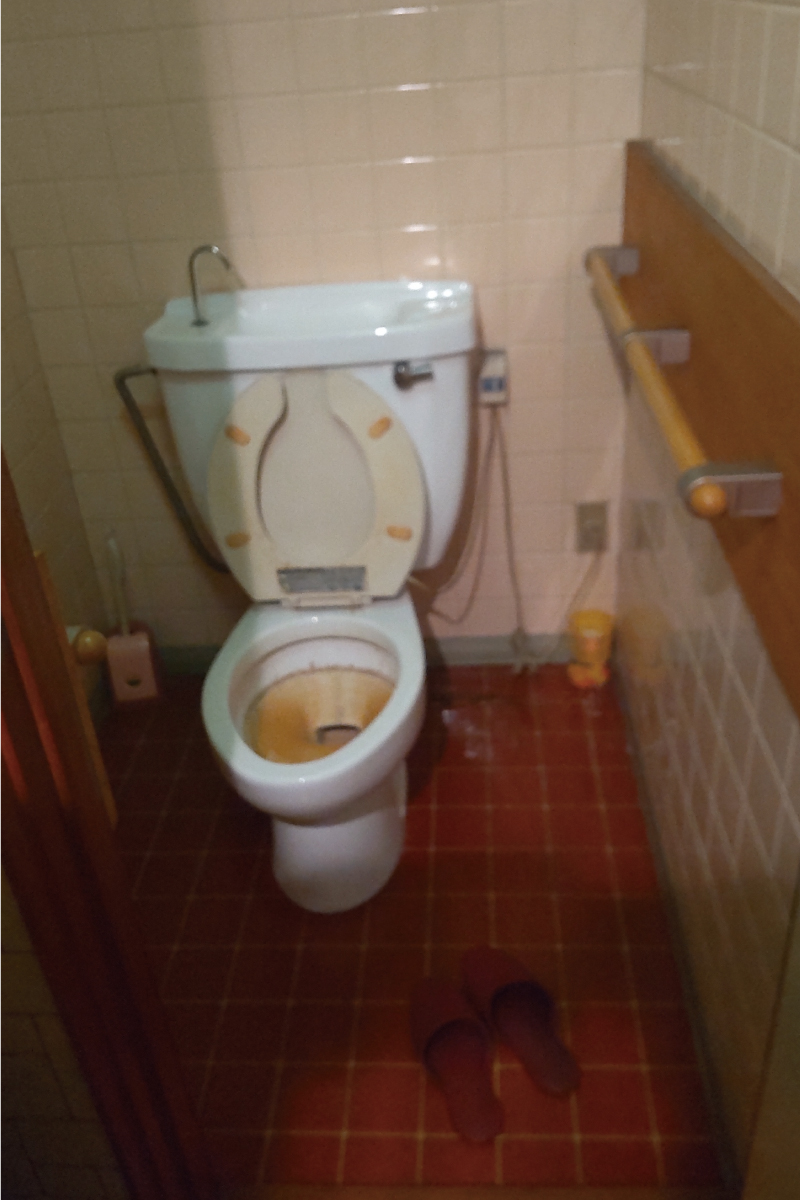 ビフォー